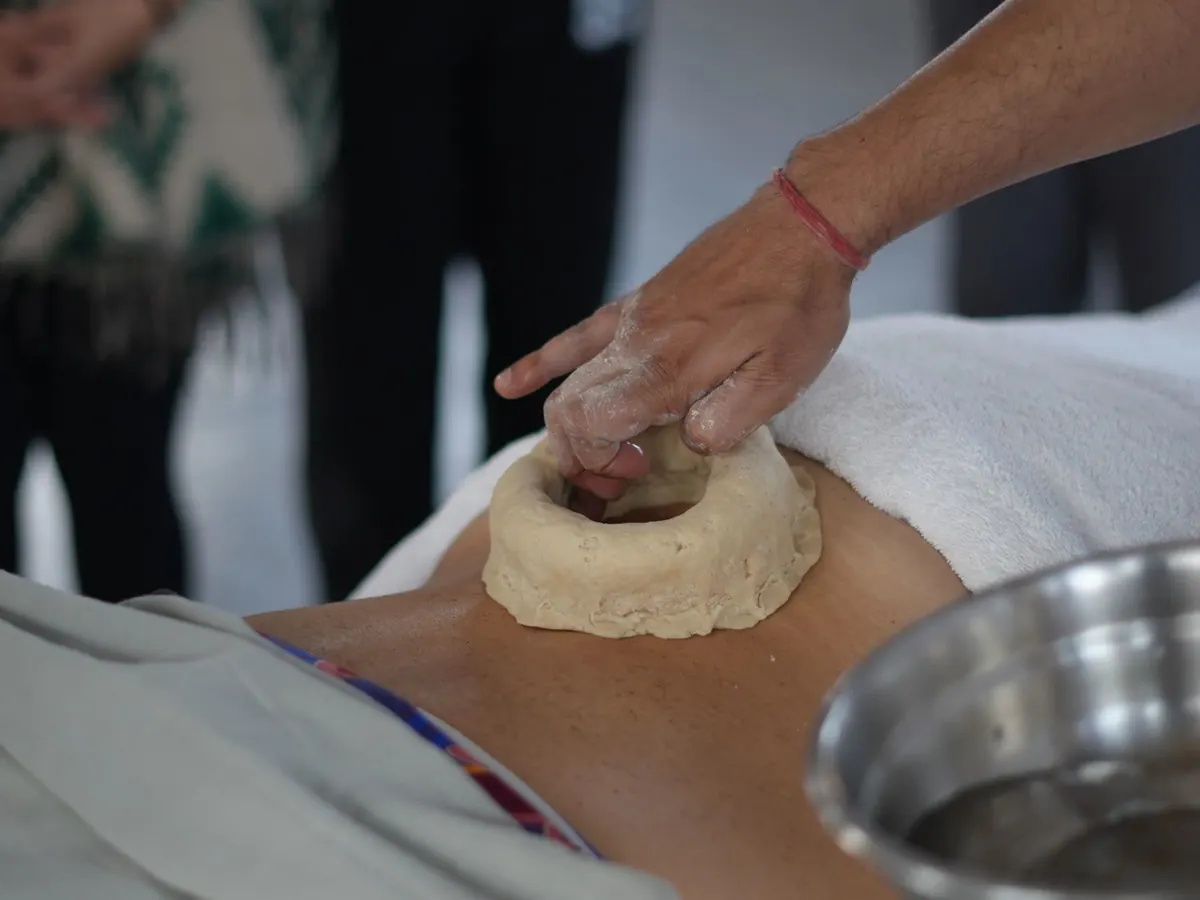 An Ayurvedic Kati Basti therapy in progress
